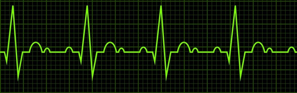 The Cardiovascular Monoblog